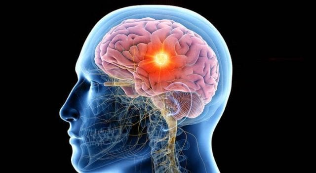 Εγκέφαλος - όγκος - Τεχνητή Νοημοσύνη