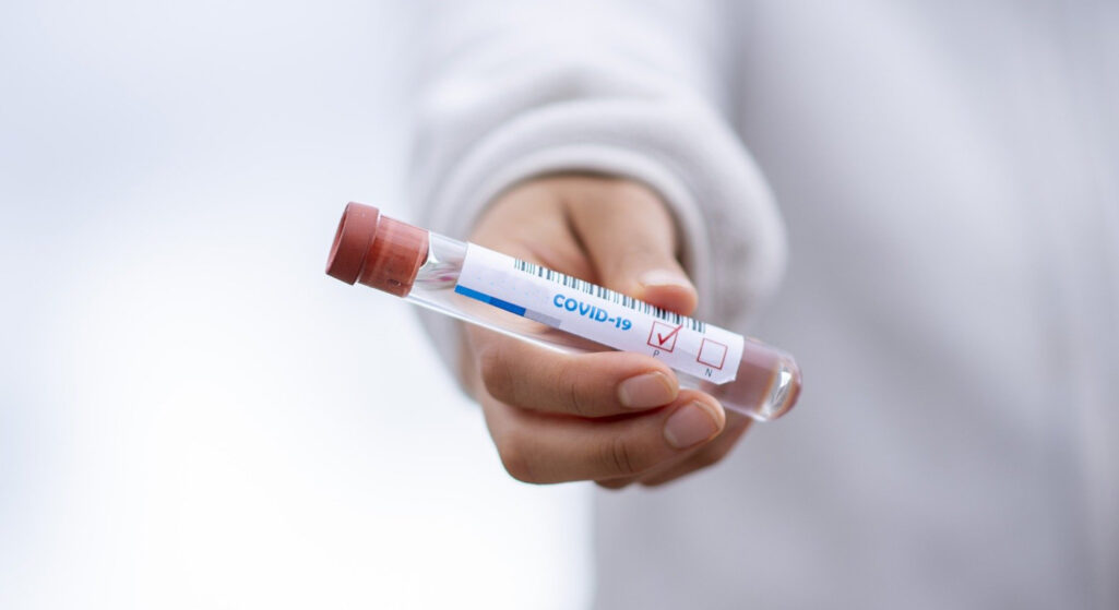 Κορονοϊός: Σε καλό δρόμο το εμβόλιο της Οξφόρδης