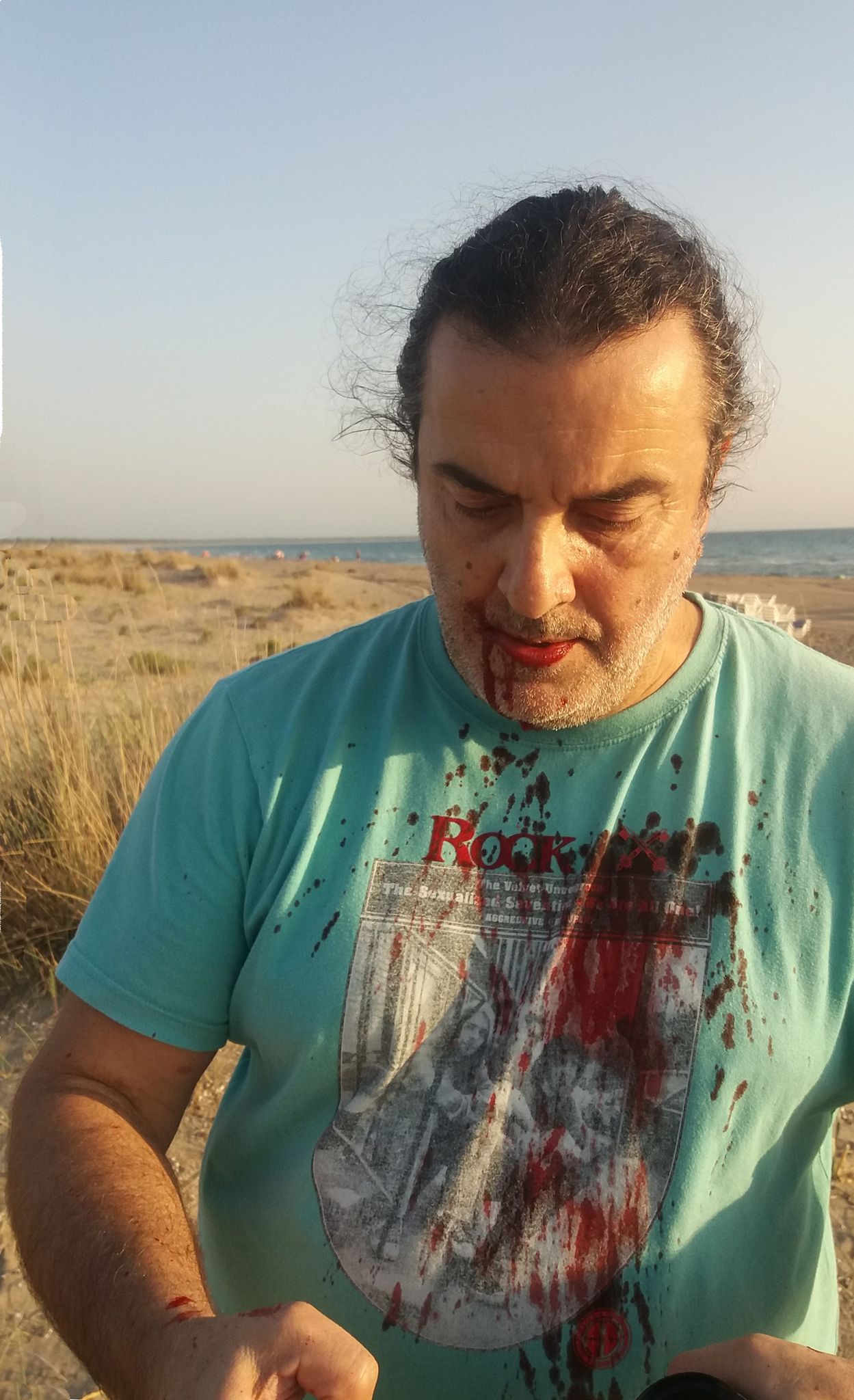 Παραλία Καλογριάς: Επίθεση με 