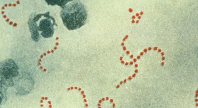 Streptococcus pyogenes bacteria