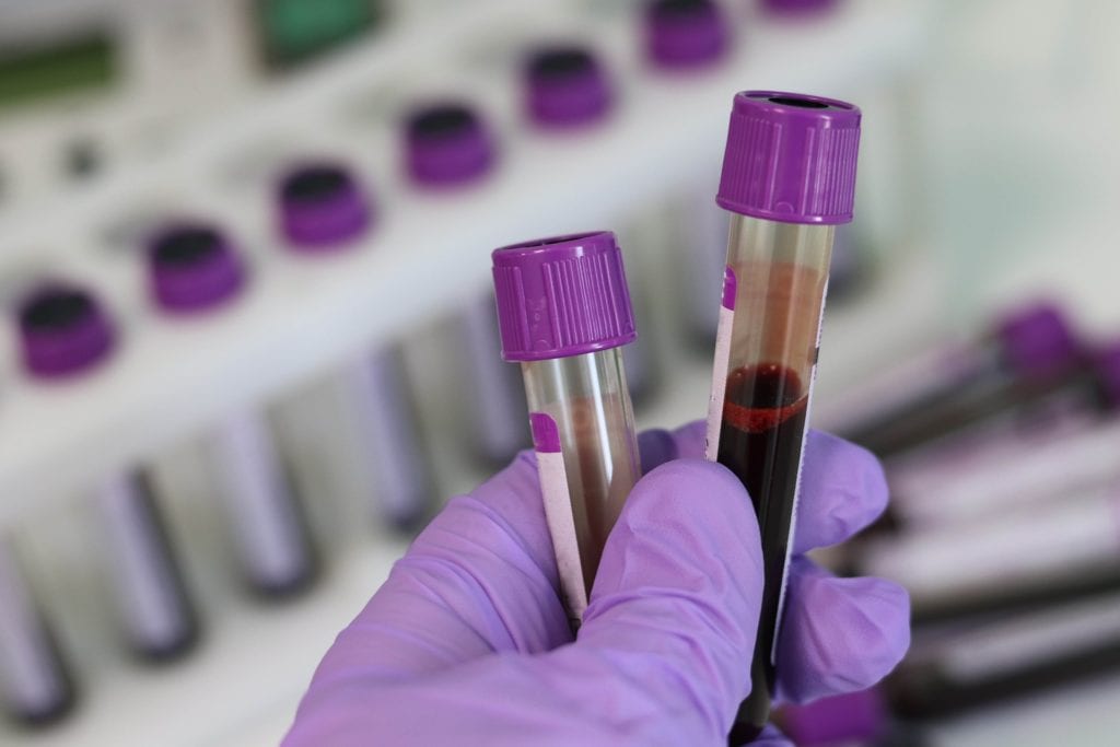 Blood laboratory test, pixabay