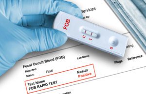 Fecal,Occult,Blood,(fob),Positive,Test,Result,By,Using,Rapid