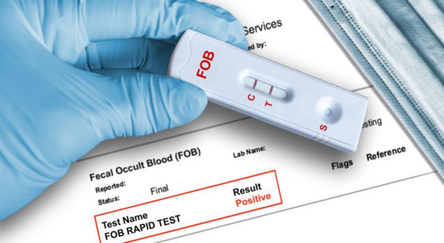 Fecal,Occult,Blood,(fob),Positive,Test,Result,By,Using,Rapid