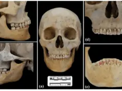 skeletos red
